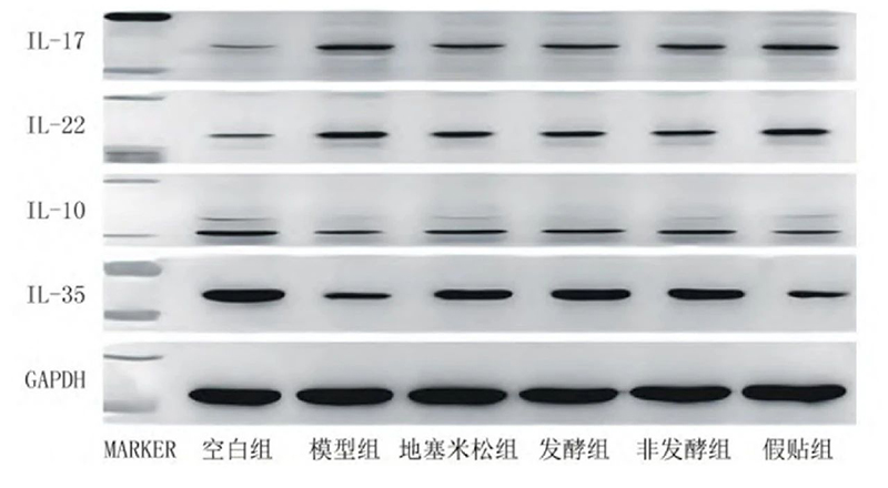空白組和支氣管哮喘各組大鼠肺組織中IL－17、IL－22、IL－10、IL－35蛋白表達(dá)電泳圖